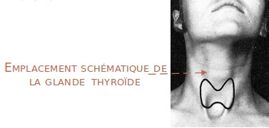 thyroidectomie-2